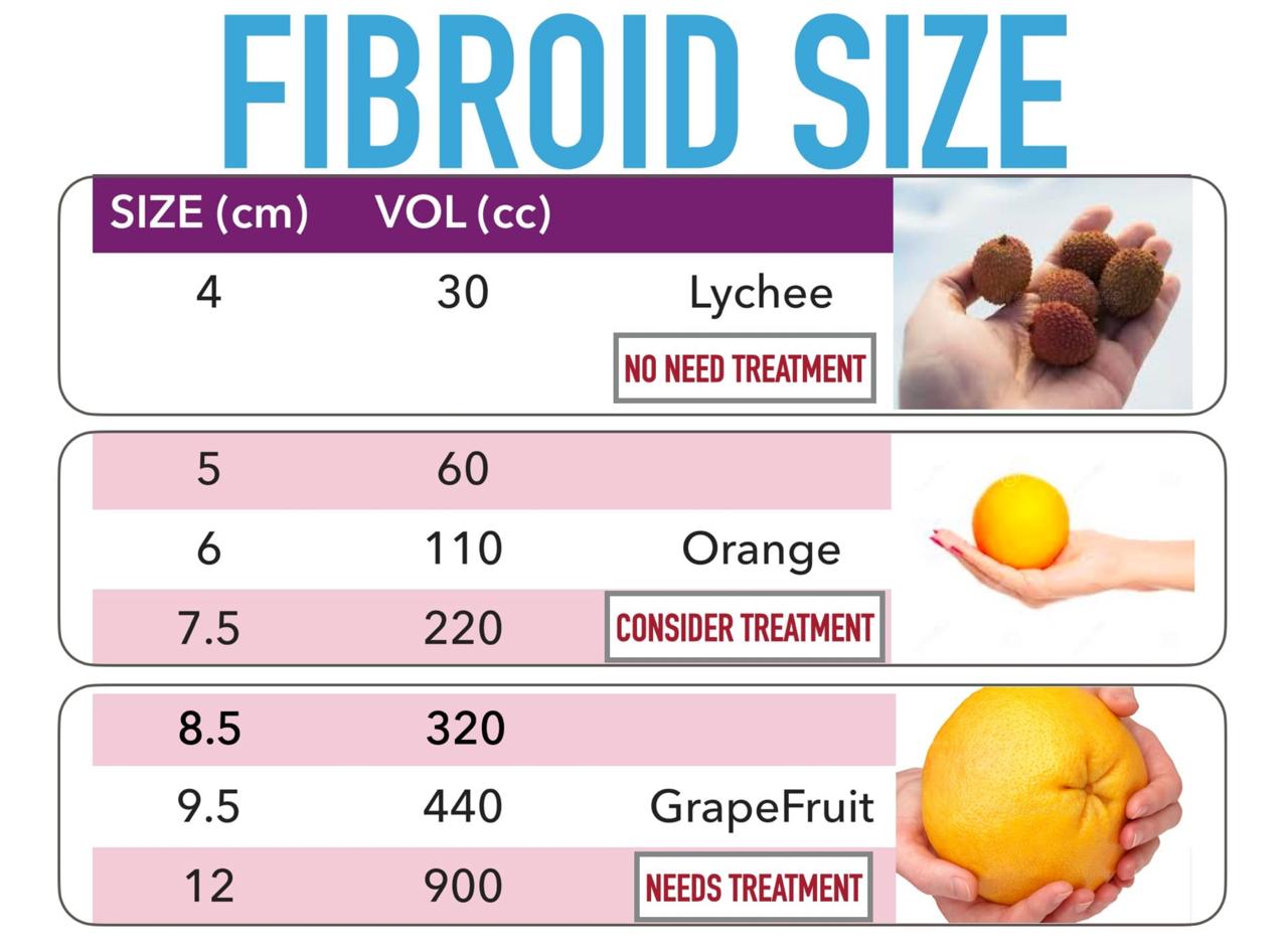 Fibroid Symptoms