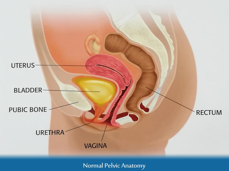 What is Pelvic Organ Prolapse?